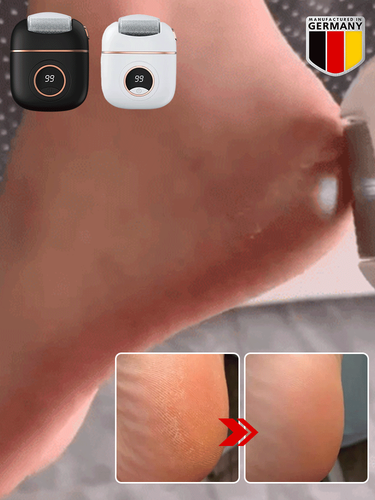 New Digital Digital Electric Foot Polisher