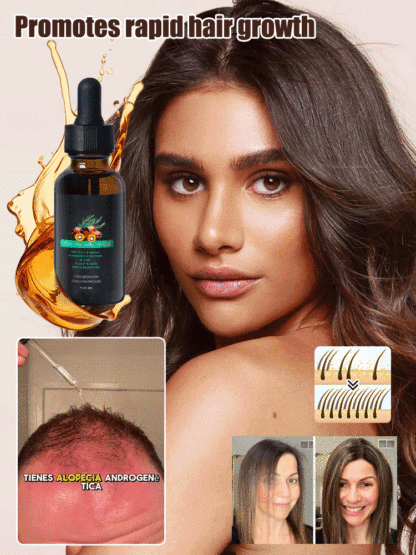 Rosemary Batanay Oil Hair Growth Essential Oil--Tired of dry, brittle, or thinning hair that just won’t grow? 😩