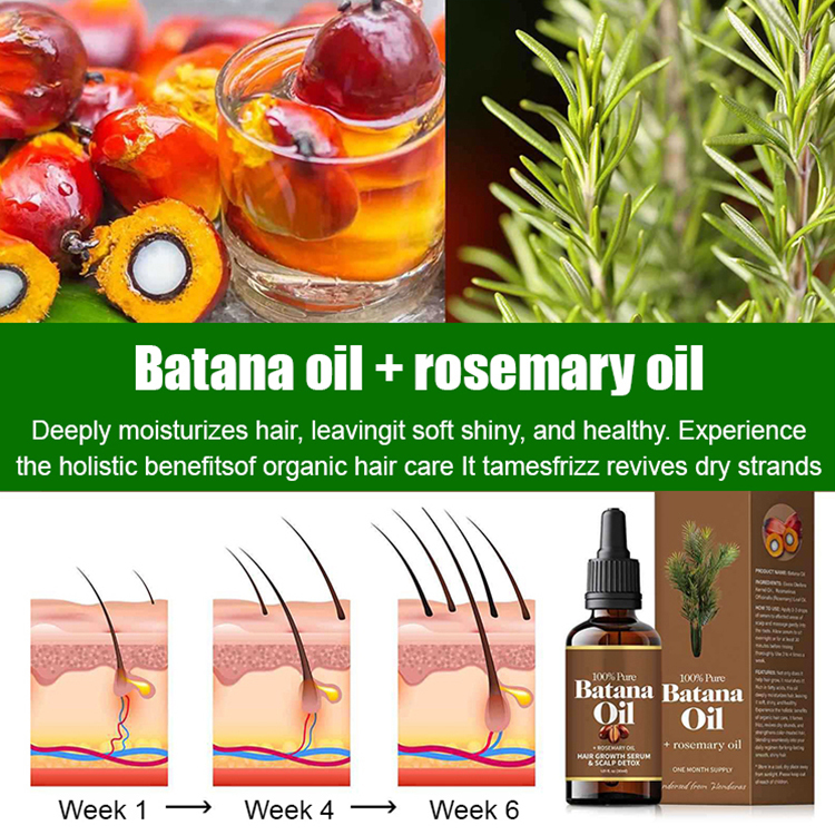 💥Order now and enjoy 50% off! Say goodbye to hair loss! Get thick, shiny hair with just three uses! Half price!