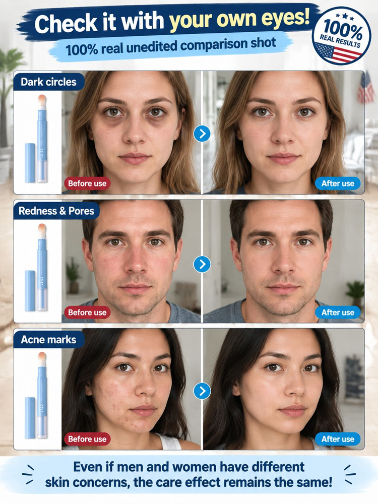 🌼【Flawless Concealer】Easily covers imperfections for flawless skin, giving you confidence every day! 