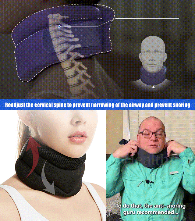 Three-stage adjustable neck brace to stop snoring