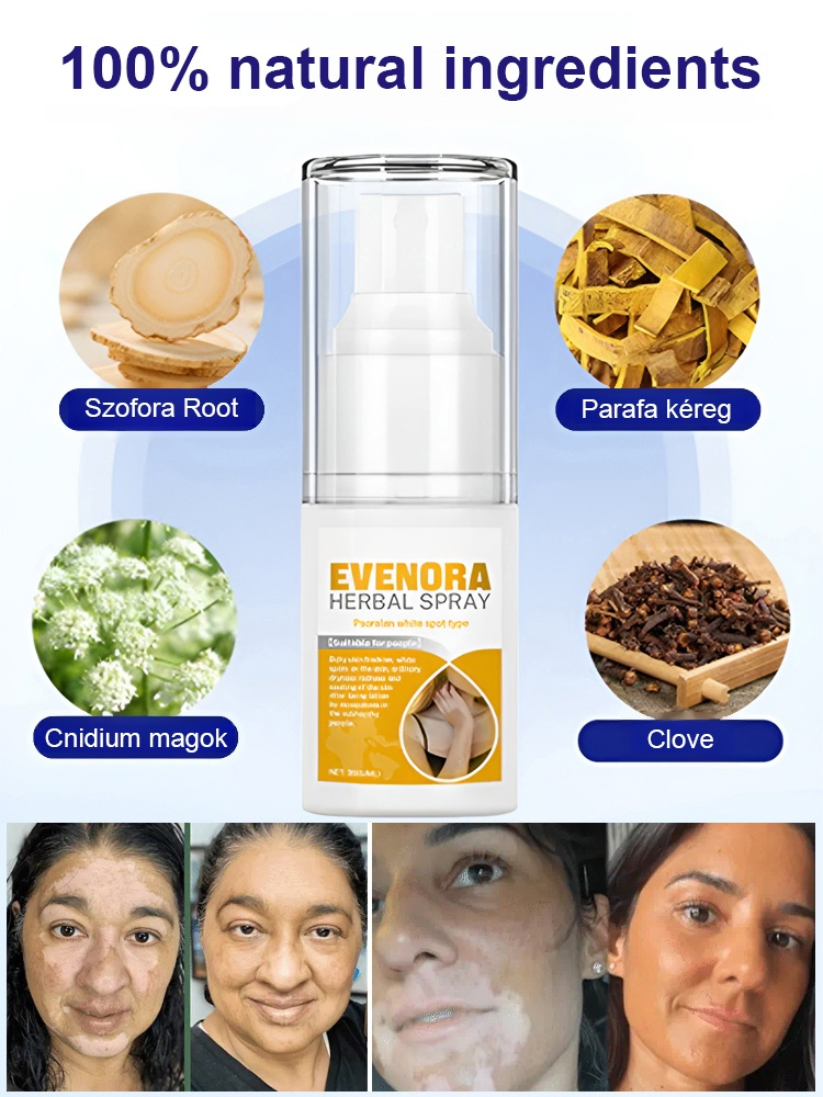 HOUKEA Herbal Spray for White Spots