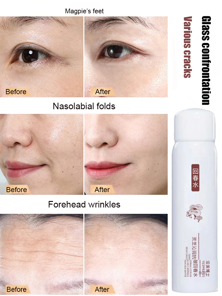 [Designed for those with eye wrinkles] Lingzhi Anti-Wrinkle Essence