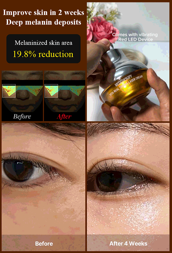 Electric Laser Massage Cream Whitening & Wrinkle Reduction