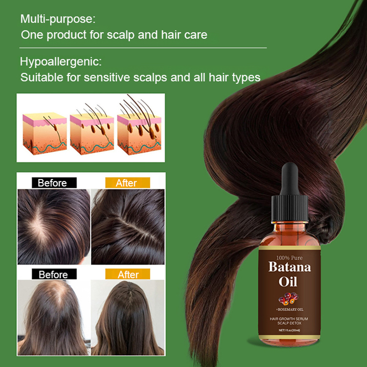 💥Order now and enjoy 50% off! Say goodbye to hair loss! Get thick, shiny hair with just three uses! Half price!