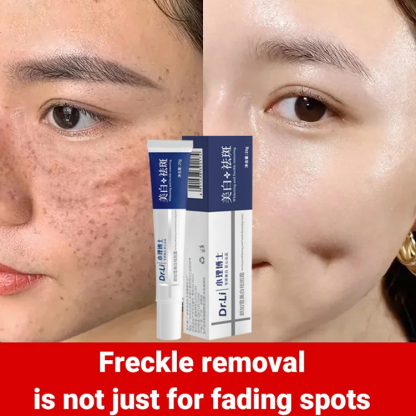 Dr. Xiaoli Japan Whitening Freckle Cream
