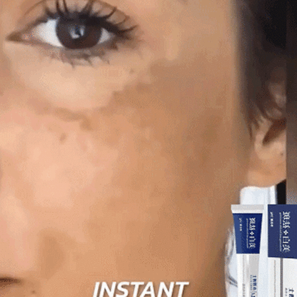 Dr. Xiaoli Japan Whitening Freckle Cream