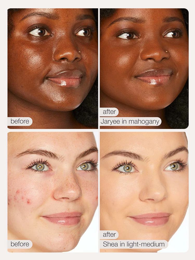 Blemish Wrinkle Management Moisturizing Cream