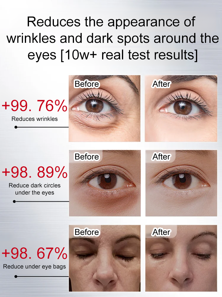 【Eliminate wrinkles in 30 seconds!】Anti-wrinkle essence eye cream