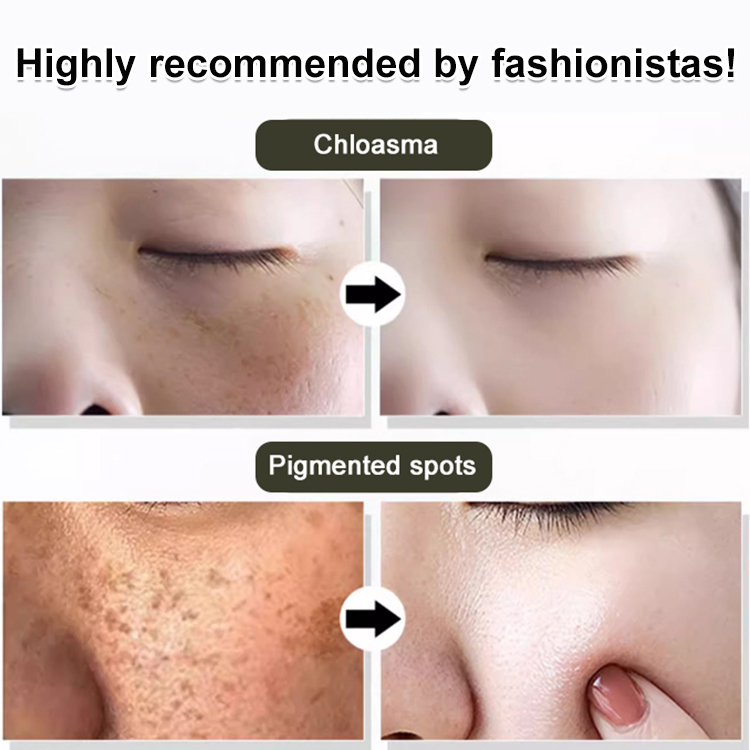 Dr. Xiaoli Japan Whitening Freckle Cream