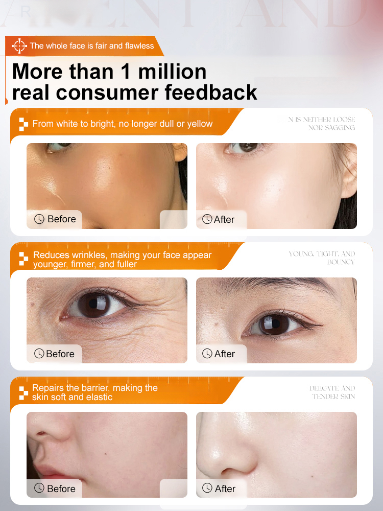 【Full-Face Firming & Wrinkle-Free】VC Wrinkle-Reducing Serum