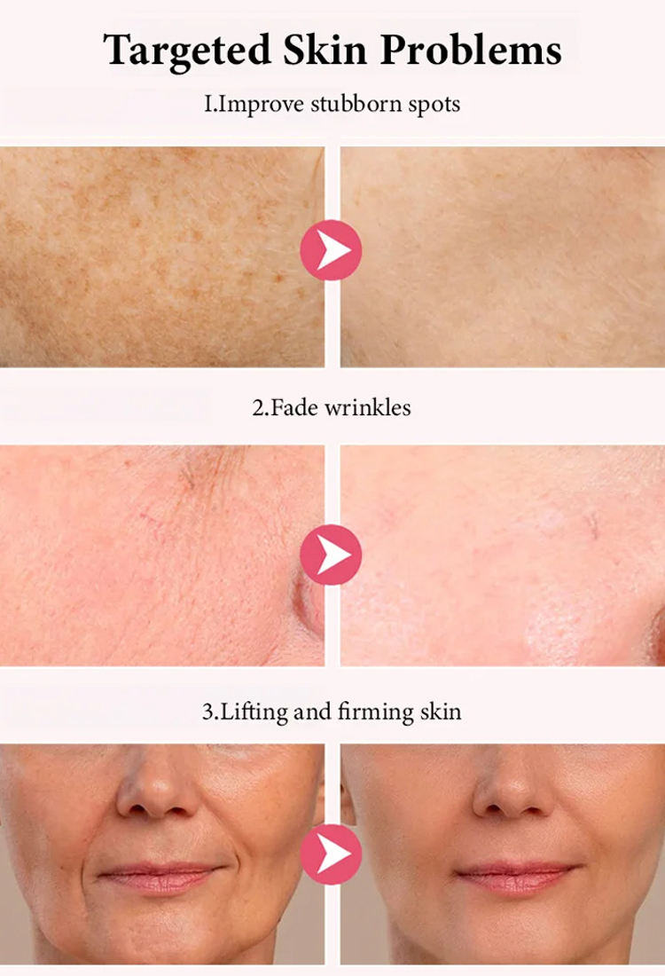 Electric Laser Massage Cream Whitening & Wrinkle Reduction