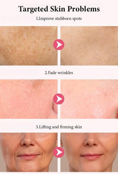 Electric Laser Massage Cream Whitening & Wrinkle Reduction