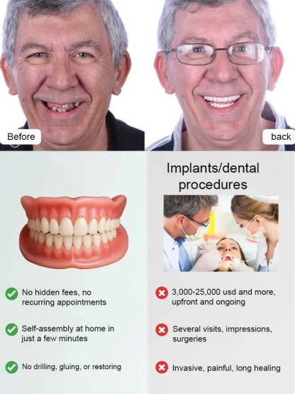 Naturally Sitting Dentures