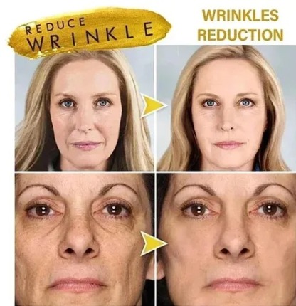 GOLD FOIL PEEL-OFF MASK