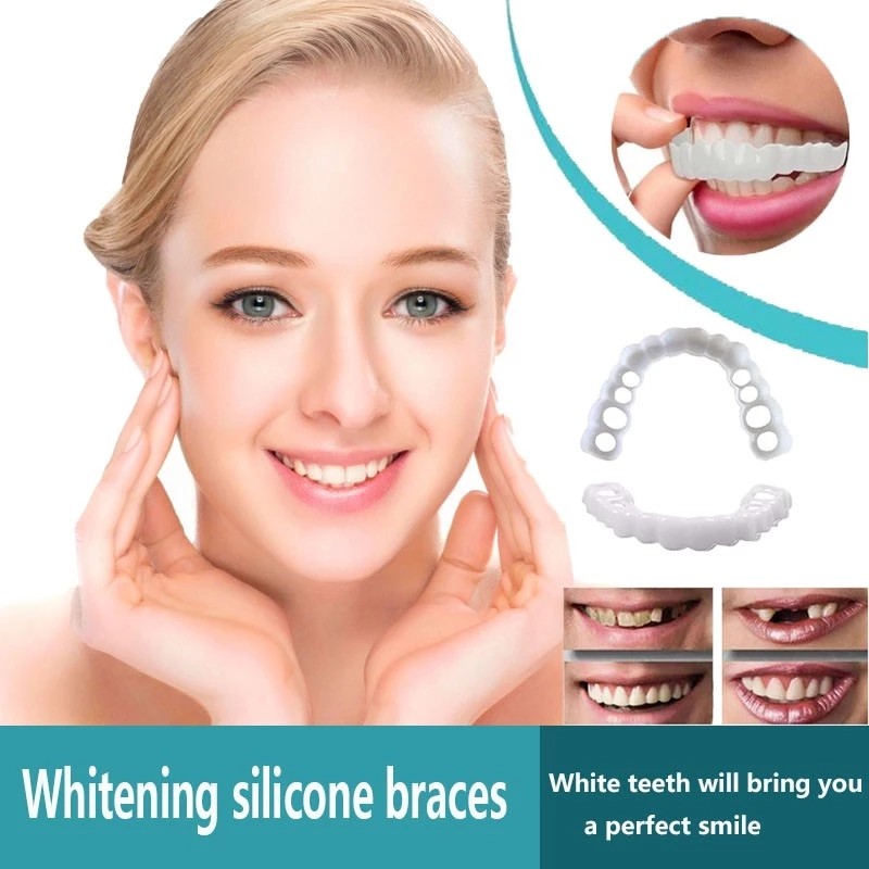 Perfect Smile Snap-On Braces