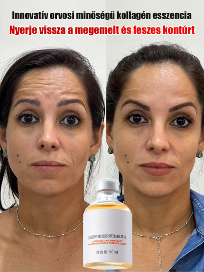 Ne pazarolj pénzt víz alapú krémekre, amik a felszínen maradnak! 🛑 Ismerd meg a 3. generációs aktív kollagén esszenciát. A hagyományos bőrápolással ellentétben a mi formulánk 0% vizet tartalmaz – 100%-ban nagy koncentrációjú, kis molekulájú kollagén, ame