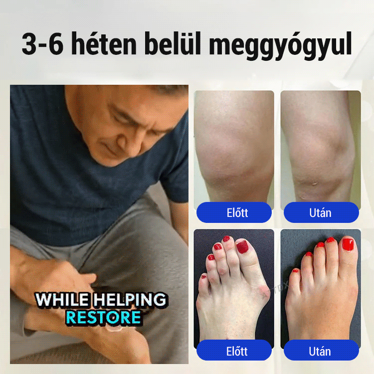 Lábidegápoló krém ✅ Célzott enyhülés: Gyorsan beszívódik és ott hat, ahol a legnagyobb a szükség.