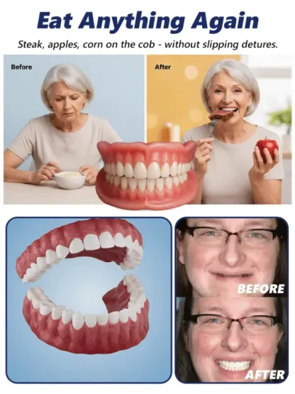 🔥【FDA & BDA Dually Certified Realistic Denture Kit】🦷 Instantly covers gaps, crooked teeth, missing teeth, stained or yellowed teeth—reveal a confident smile!