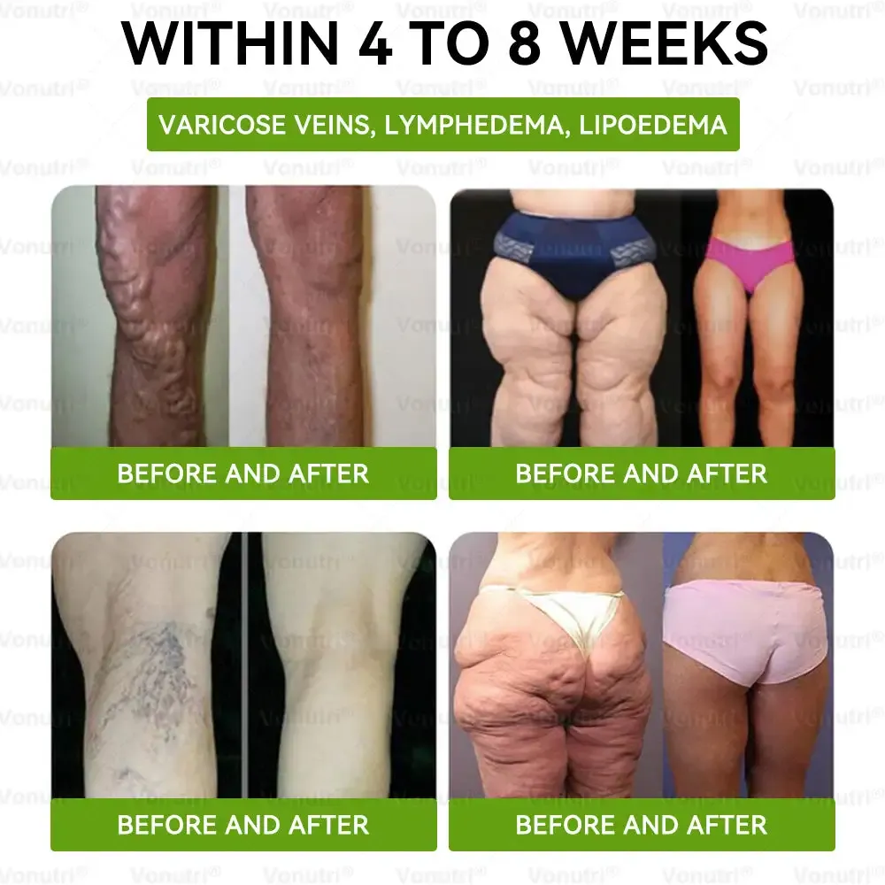 Vonutri® Moringa · Berberine × EGCG 10-in-1 Advanced Nano Microneedle Patch