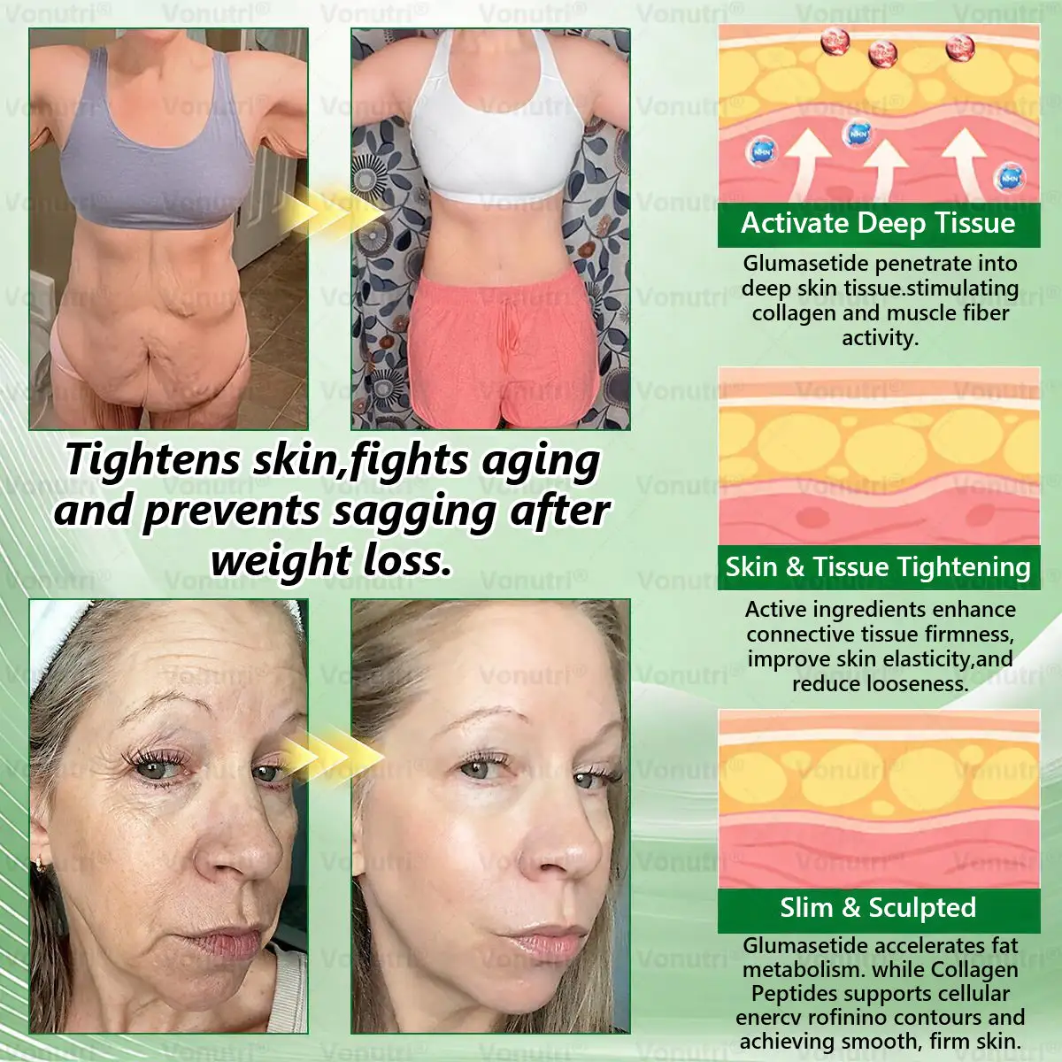 Vonutri® Moringa · Berberine × EGCG 10-in-1 Advanced Nano Microneedle Patch