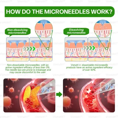 Vonutri® Moringa · Berberine × EGCG 10-in-1 Advanced Nano Microneedle Patch
