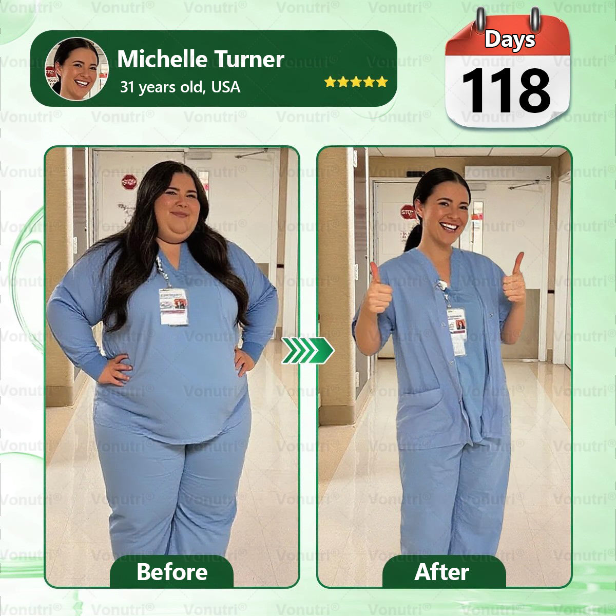 𝑶𝒇𝒇𝒊𝒄𝒊𝒂𝒍 𝑺𝒕𝒐𝒓𝒆 | 👩‍⚕️🎁𝙑𝙤𝙣𝙪𝙩𝙧𝙞® 𝑴𝒐𝒓𝒊𝒏𝒈𝗮 · 𝗕𝗲𝗿𝗯𝗲𝗿𝙞𝙣𝙚 × 𝑬𝑮𝑪𝑮 10-in-1 Advanced Nano Microneedle Patch🇺🇸(𝐉𝐮𝐬𝐭 𝐨𝐧𝐜𝐞 𝐚 𝐝𝐚𝐲, 𝐯𝐢𝐬𝐢𝐛𝐥𝐞 𝐜𝐡𝐚𝐧𝐠𝐞𝐬 𝐢𝐧 𝟕 𝐝𝐚𝐲𝐬） ✅ 𝐅𝐨𝐫 𝐨𝐛𝐞𝐬𝐢𝐭𝐲, 🅛🅞🅞🅢🅔 🅢🅚🅘🅝,𝐝𝐢𝐚𝐛𝐞𝐭𝐞𝐬, 𝐬𝐥𝐞𝐞𝐩 𝐚𝐩𝐧𝐞𝐚, 𝐣𝐨𝐢𝐧𝐭 𝐢𝐬𝐬𝐮𝐞𝐬, 𝐚𝐧𝐝 𝐦𝐨𝐫𝐞,lj02