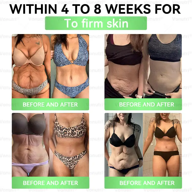 Vonutri® Moringa · Berberine × EGCG 10-in-1 Advanced Nano Microneedle Patch