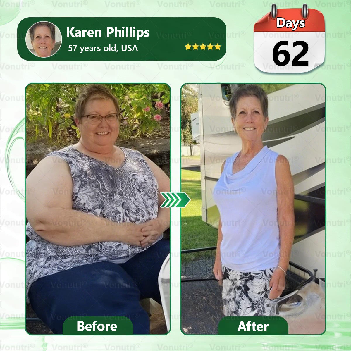 𝑶𝒇𝒇𝒊𝒄𝒊𝒂𝒍 𝑺𝒕𝒐𝒓𝒆 | 👩‍⚕️🎁𝙑𝙤𝙣𝙪𝙩𝙧𝙞® 𝑴𝒐𝒓𝒊𝒏𝒈𝗮 · 𝗕𝗲𝗿𝗯𝗲𝗿𝙞𝙣𝙚 × 𝑬𝑮𝑪𝑮 10-in-1 Advanced Nano Microneedle Patch🇺🇸(𝐉𝐮𝐬𝐭 𝐨𝐧𝐜𝐞 𝐚 𝐝𝐚𝐲, 𝐯𝐢𝐬𝐢𝐛𝐥𝐞 𝐜𝐡𝐚𝐧𝐠𝐞𝐬 𝐢𝐧 𝟕 𝐝𝐚𝐲𝐬） ✅ 𝐅𝐨𝐫 𝐨𝐛𝐞𝐬𝐢𝐭𝐲, 🅛🅞🅞🅢🅔 🅢🅚🅘🅝,𝐝𝐢𝐚𝐛𝐞𝐭𝐞𝐬, 𝐬𝐥𝐞𝐞𝐩 𝐚𝐩𝐧𝐞𝐚, 𝐣𝐨𝐢𝐧𝐭 𝐢𝐬𝐬𝐮𝐞𝐬, 𝐚𝐧𝐝 𝐦𝐨𝐫𝐞,lj02