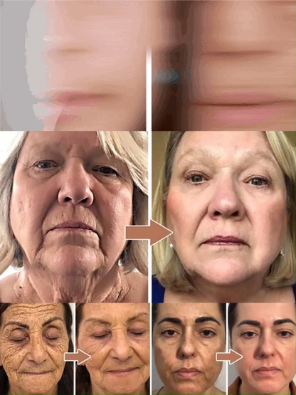 【Facial Restoration Miracle】Microcurrent Firming Beauty Device