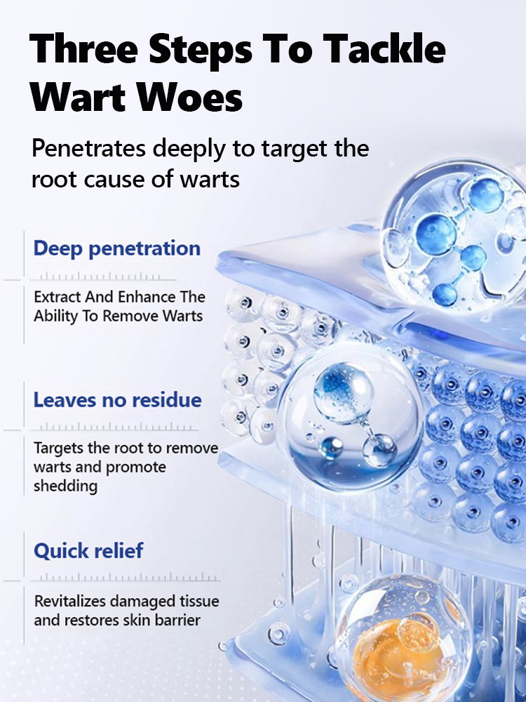 Ice Sensation Painless Wart Removal! Penetrates to the Root in 30 Seconds, No Damage to Healthy Skin – Money-Back Guarantee if Ineffective💯