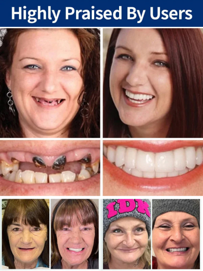 [FDA Certified] Perfectly Fitting Custom-Made Dentures