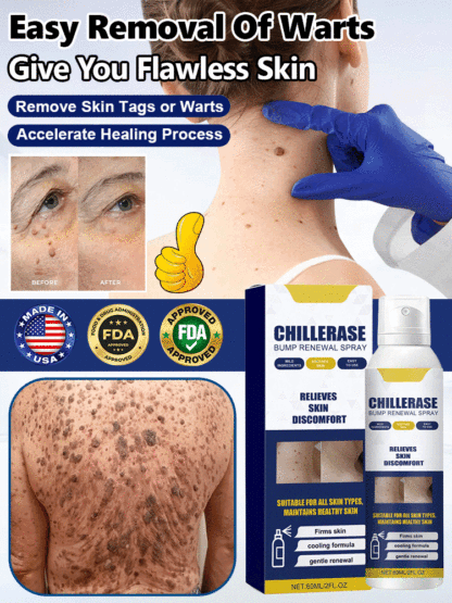 Ice Sensation Painless Wart Removal! Penetrates to the Root in 30 Seconds, No Damage to Healthy Skin – Money-Back Guarantee if Ineffective💯