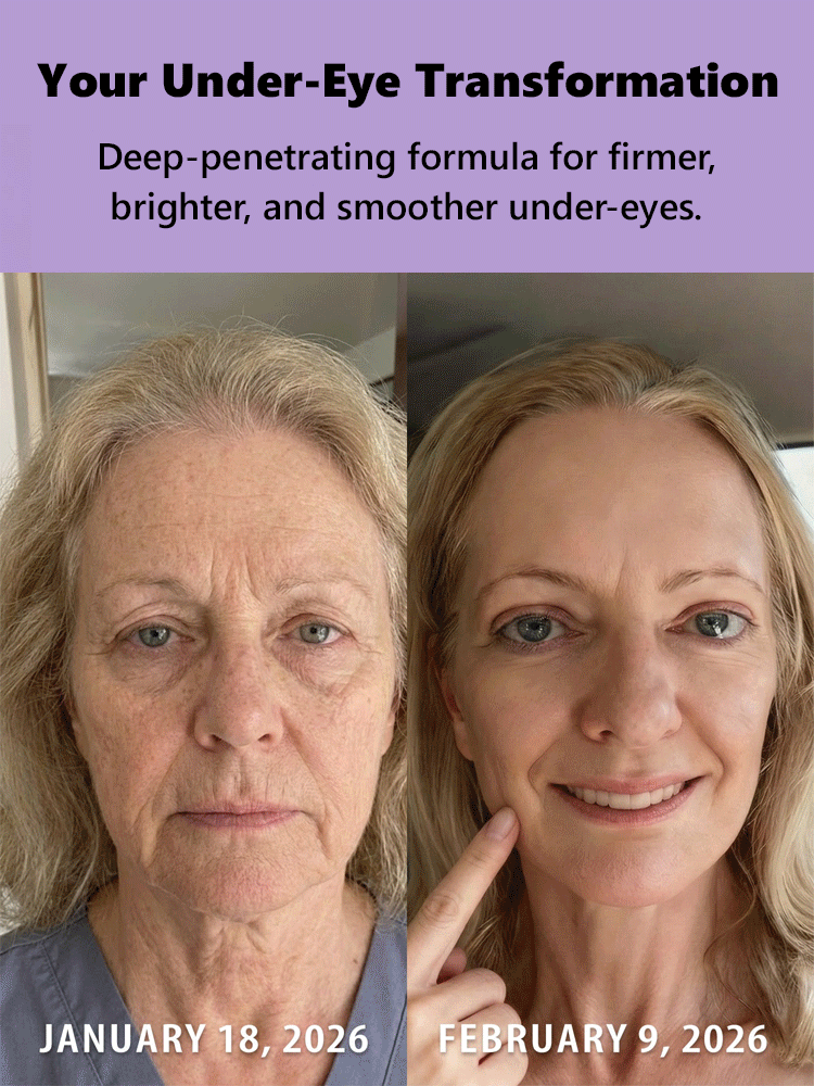 [The more severe the condition, the better the effect] Anti-wrinkle microneedle eye patches
