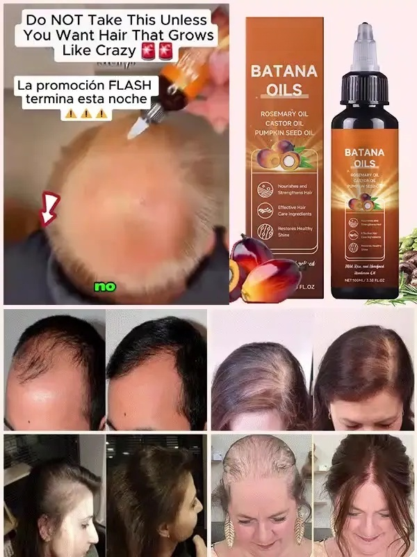 2 Weeks to Regrow Hair Like Crazy 🌱Batana Hair Oil - Hair Explosion Mode ON🔥Buy One Get One FREE 🎁
