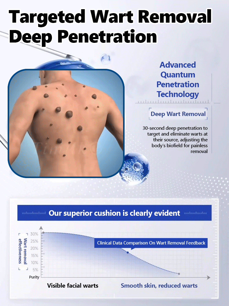 Ice Sensation Painless Wart Removal! Penetrates to the Root in 30 Seconds, No Damage to Healthy Skin – Money-Back Guarantee if Ineffective💯