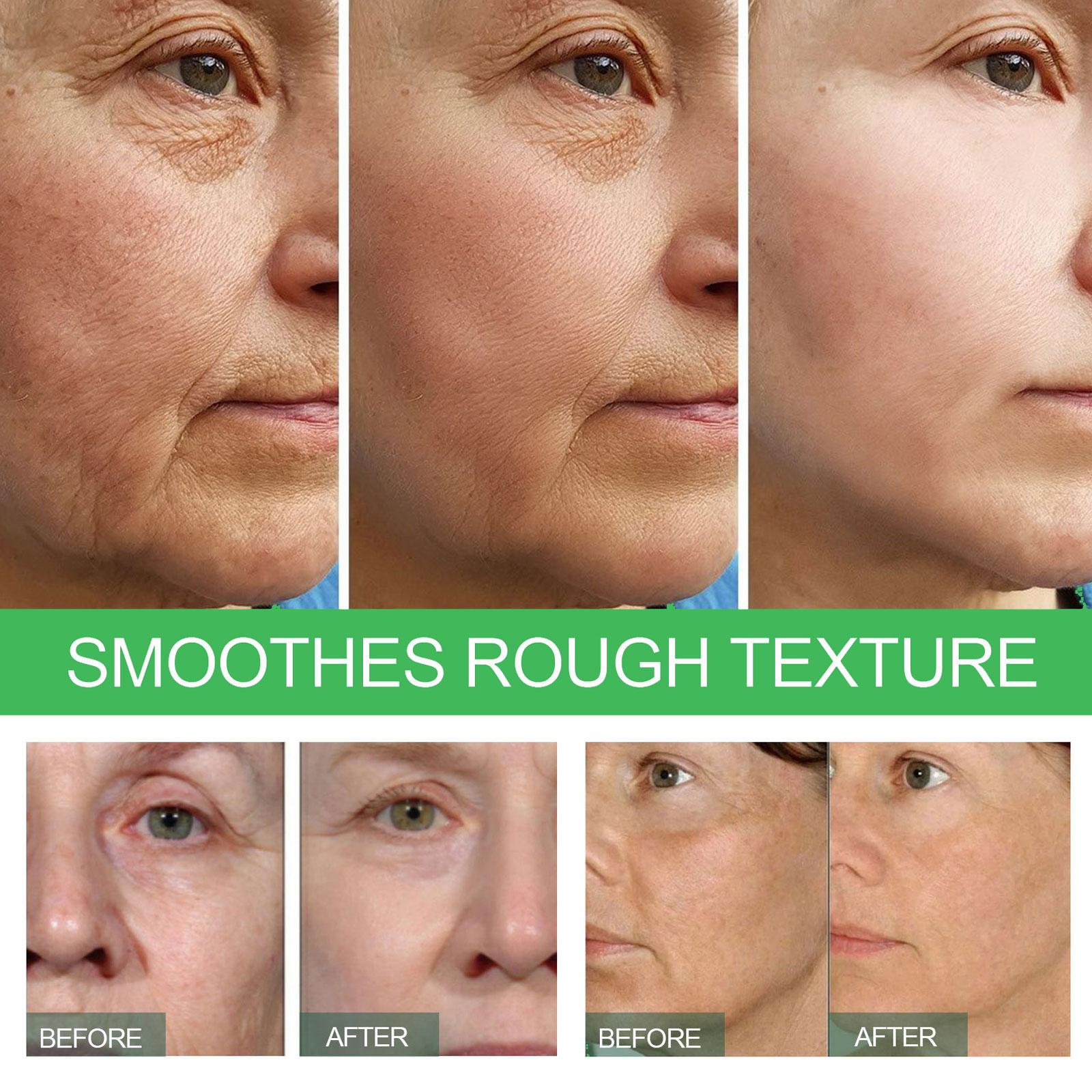 EELHOE™ Deep Anti-Wrinkle and Anti-Aging Serum