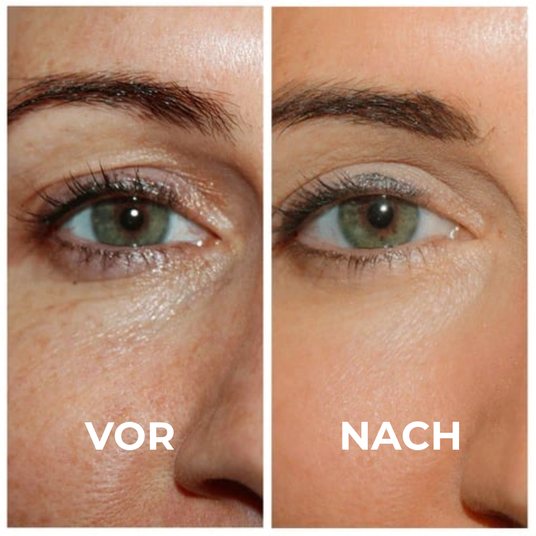 Professionelles Straffendes Augen-Gel