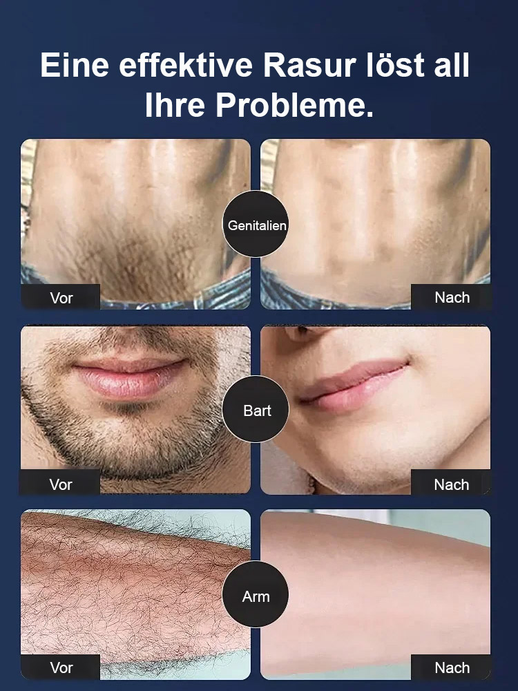 🔥50 % Rabatt! Hochwertiger Elektrorasierer, sanft zur Haut, langanhaltende Rasur