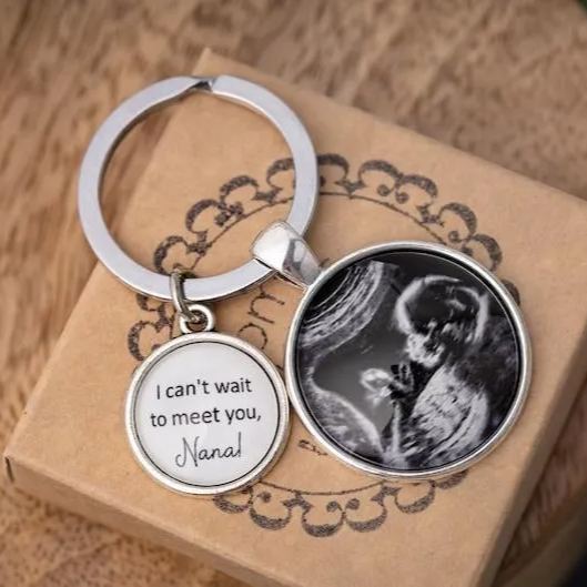 Personalized Ultrasound Photo Keychain, Pregnancy Gifts, Custom Daddy Keychain, Ultrasound Gifts, Mothers Day Gift, Father, New Dad, S-1