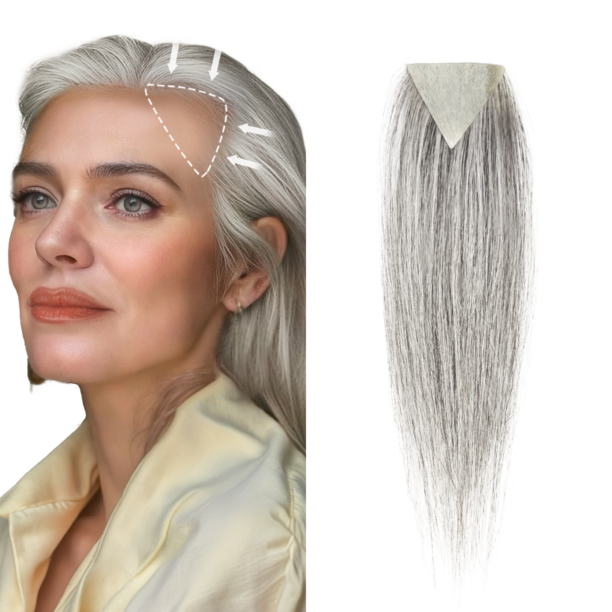 Meiverah Triangular alopecia Balding Spot Accidental Burns Scar Hair Replacement for women Hairline Loss Straight Tape in Replacement Toupee 2PC (Pepper Salt#)