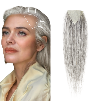 Meiverah Triangular alopecia Balding Spot Accidental Burns Scar Hair Replacement for women Hairline Loss Straight Tape in Replacement Toupee 2PC (Pepper Salt#)