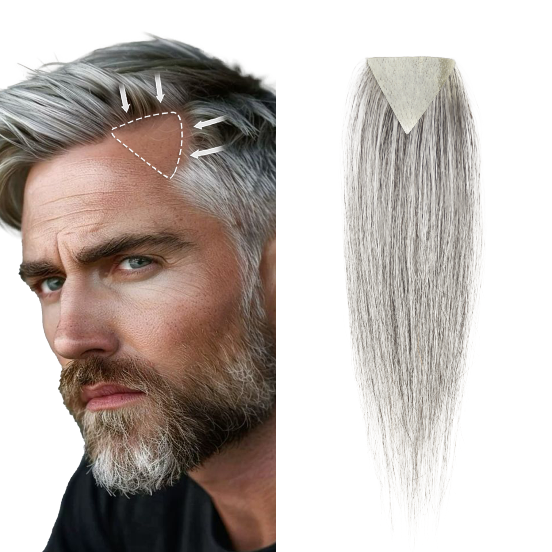 Meiverah Triangular alopecia Balding Spot Accidental Burns Scar Hair Replacement for men Hairline Loss Straight Tape in Replacement Toupee 2PC (Pepper Salt#)