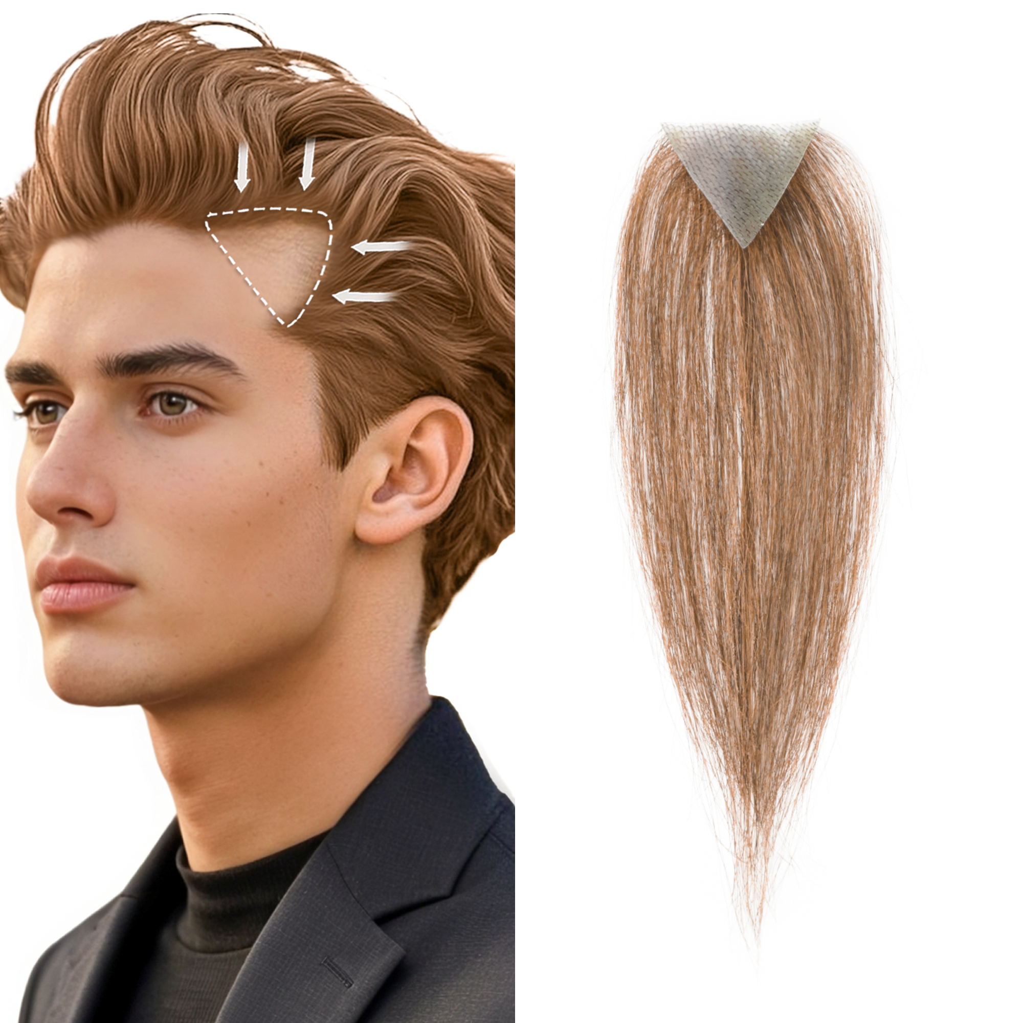 Meiverah Triangular alopecia Balding Spot Accidental Burns Scar Hair Replacement for men Hairline Loss Straight Tape in Replacement Toupee 2PC (Light Brown#)