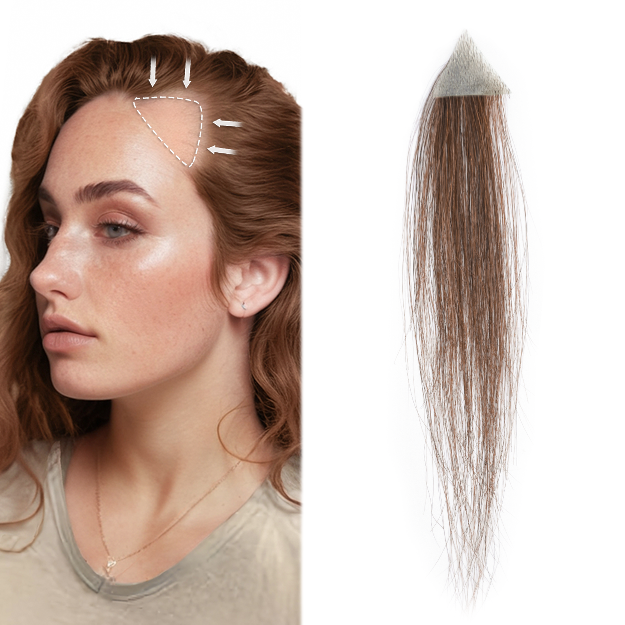 Meiverah Triangular alopecia Balding Spot Accidental Burns Scar Hair Replacement for women Hairline Loss Straight Tape in Replacement Toupee 2PC (Medium Brown#)