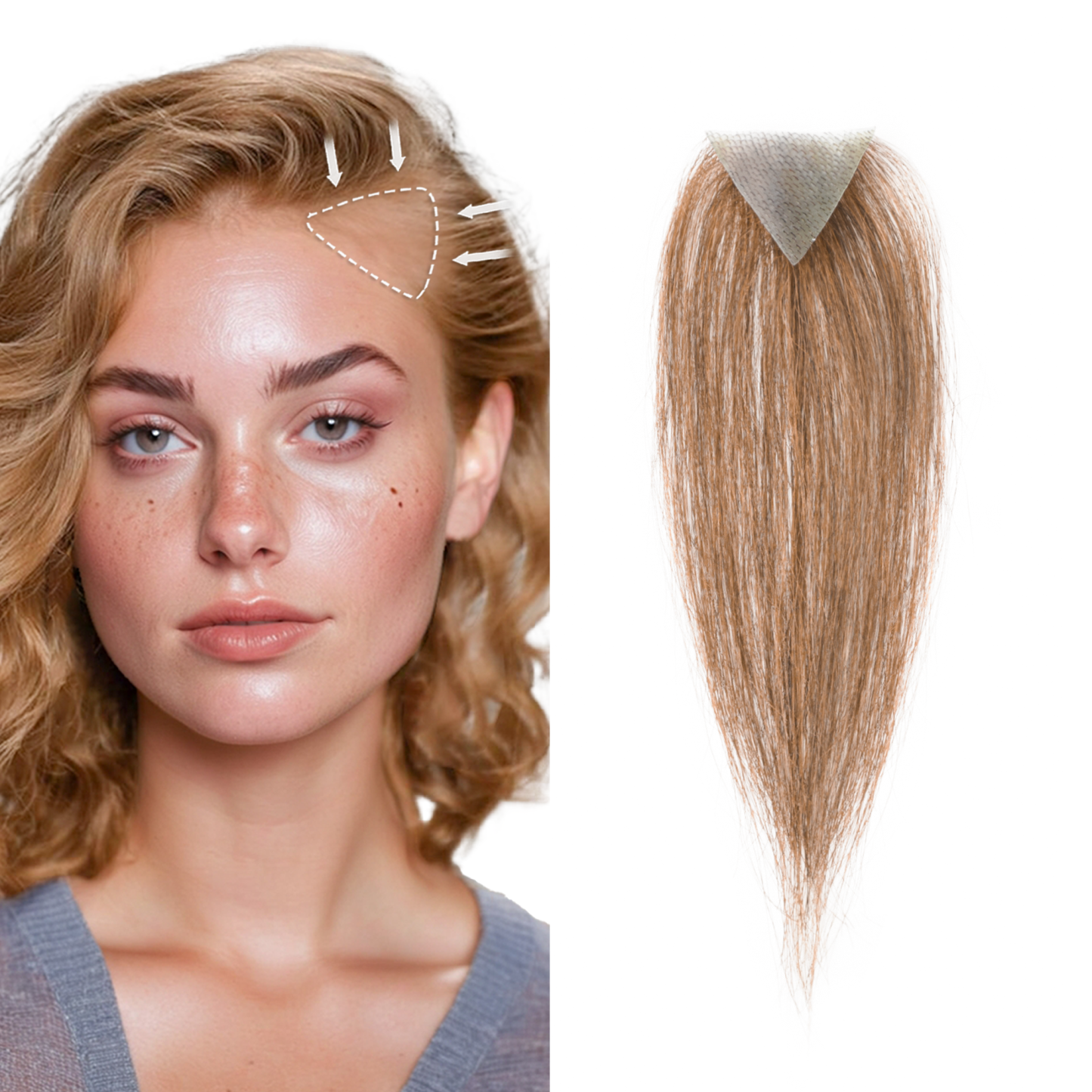 Meiverah Triangular alopecia Balding Spot Accidental Burns Scar Hair Replacement for women Hairline Loss Straight Tape in Replacement Toupee 2PC (Light Brown#)