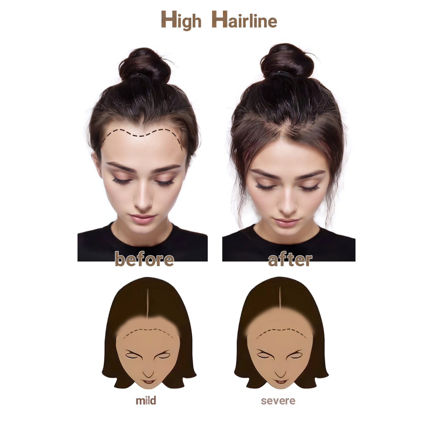 Meiverah Hair Frontal Hairpiece for Women Natural Black Hair Extension Hairline Loss Straight Tape in Human Hair Toppers Replacement Toupee (Medium Brown)