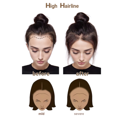 Meiverah Hair Frontal Hairpiece for Women Natural Black Hair Extension Hairline Loss Straight Tape in Human Hair Toppers Replacement Toupee (Medium Brown)