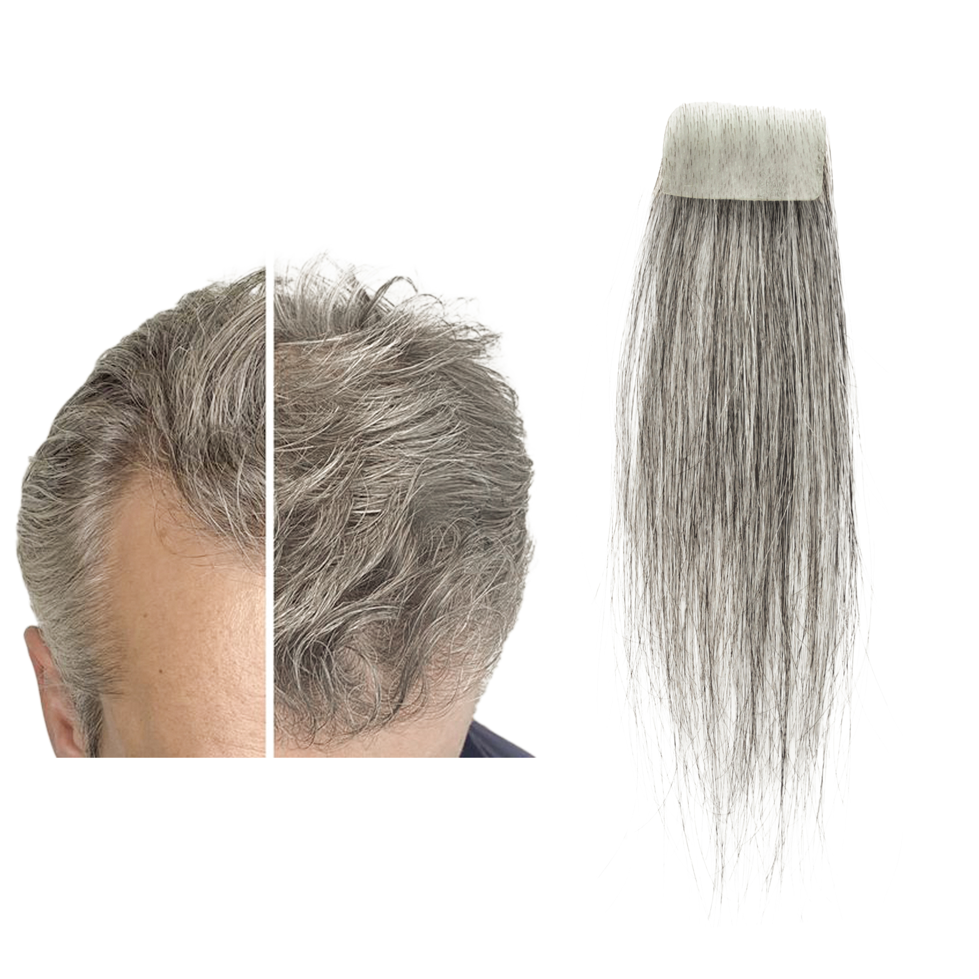Meiverah Hair scar human hair replacement Accidental burns without hair for men Hairline Loss Straight Tape in Replacement Toupee (Pepper Salt)