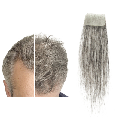 Meiverah Hair scar human hair replacement Accidental burns without hair for men Hairline Loss Straight Tape in Replacement Toupee (Pepper Salt)